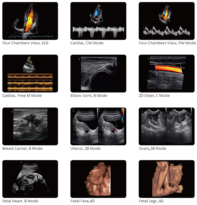 cardiac ultrasound machine
