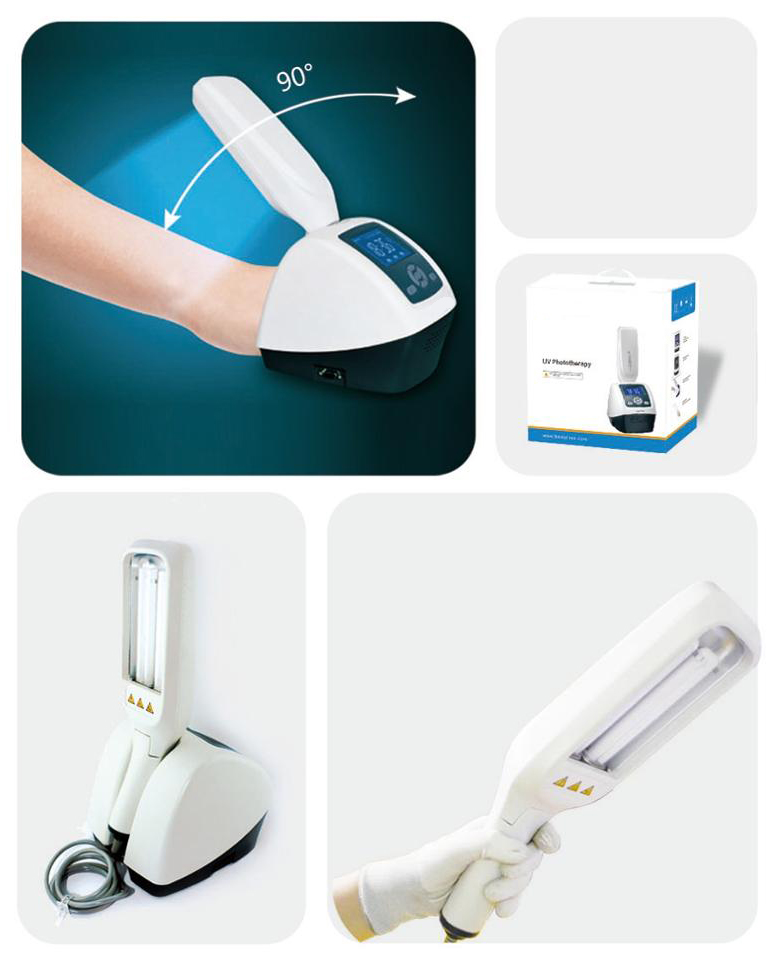 home use uv lamp vitiligo