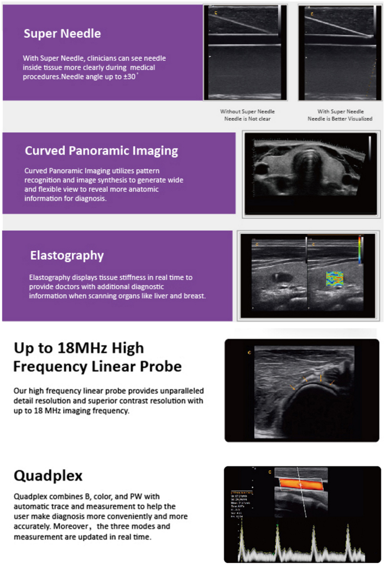 Professional Cardiac Echo Portable China Doppler Ultrasound Machine for ...