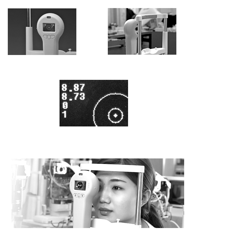 portable keratometer