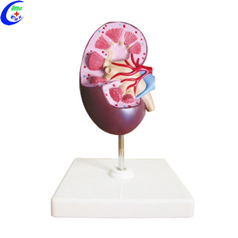 kidney model 2.jpg
