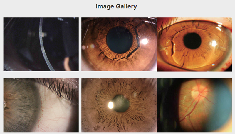 Slit Lamp Microscope 2