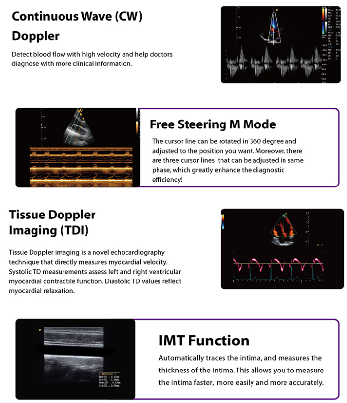 cardiac ultrasound machine