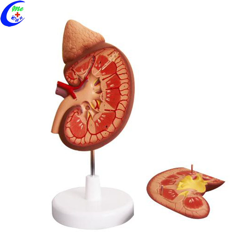 kidney model.jpg