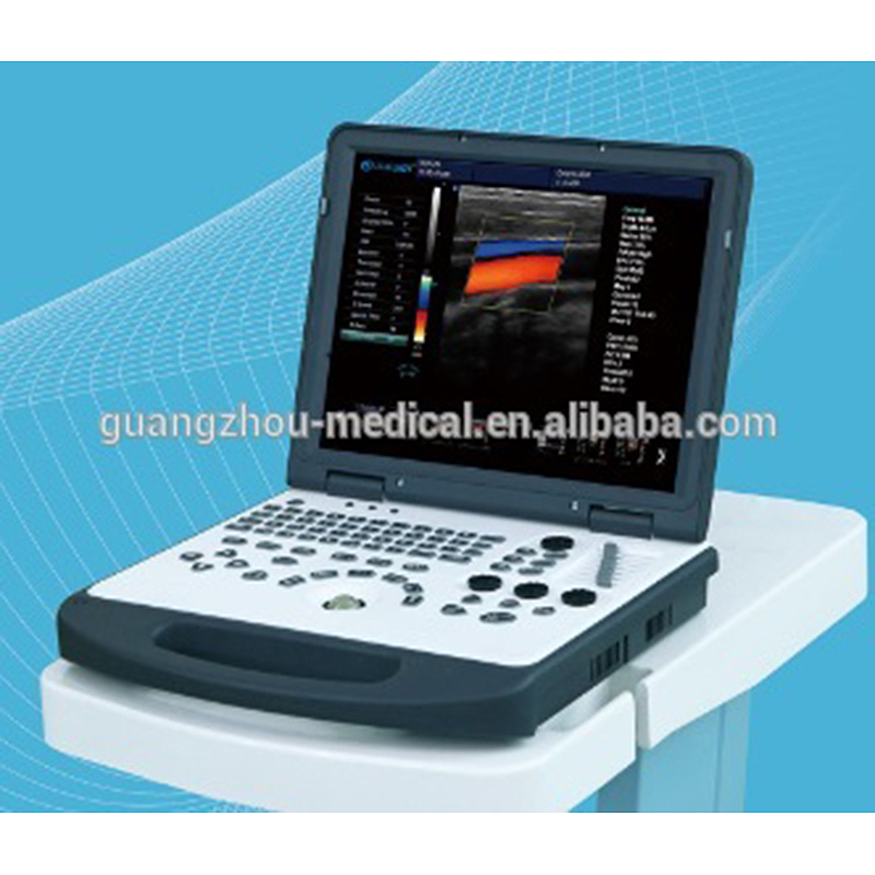 Най-добър MC-DE-C60 3D лаптоп доплеров цветен ултразвуков скенер фабрична цена - MeCan Medical