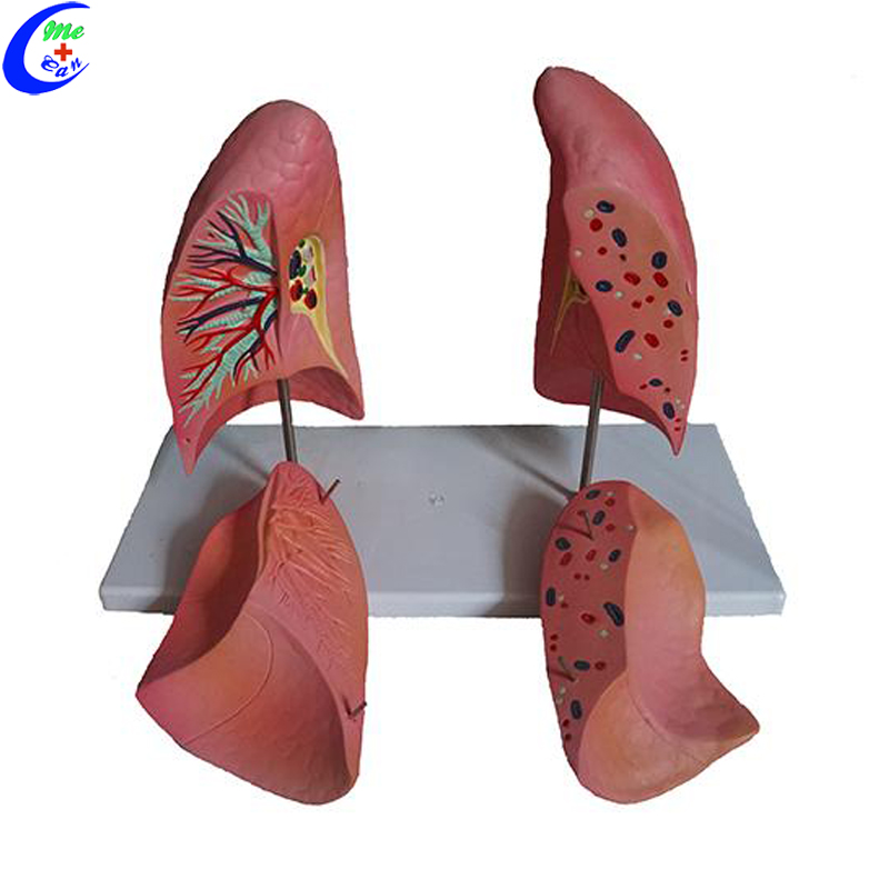 lung anatomy model.jpg