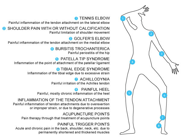 shockwave therapy machine